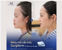 20 NGÀY “LỘT XÁC” DIỆN MẠO SAU NÂNG MŨI