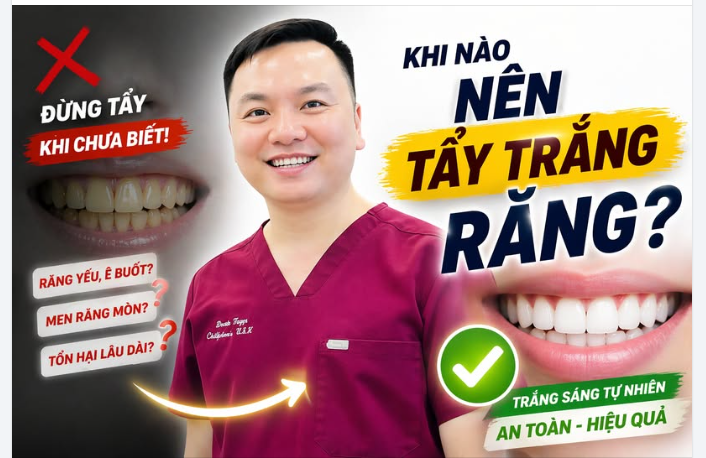 Khi nào nên tẩy trắng răng?