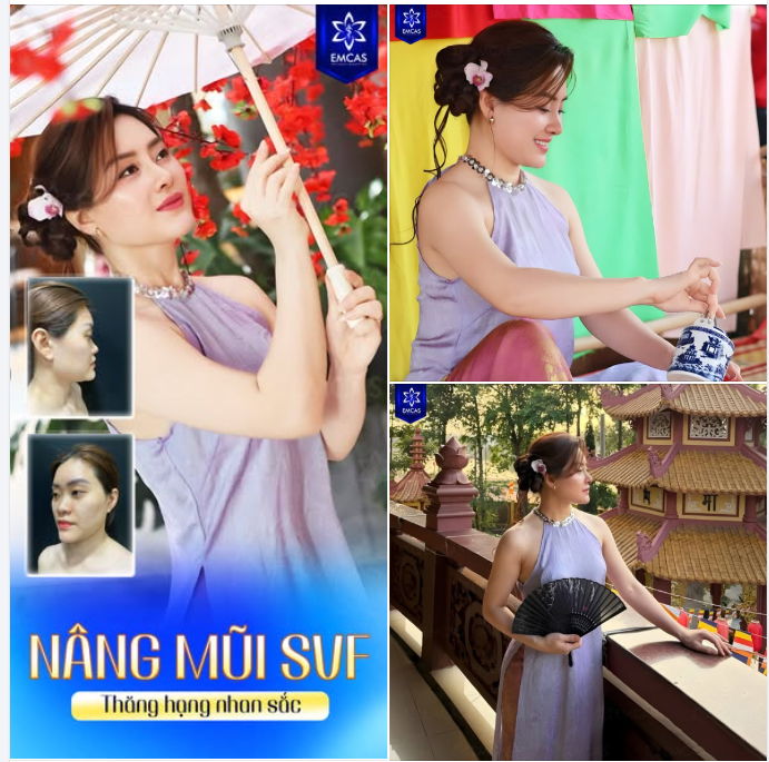 Dáng mũi đẹp tự nhiên, thanh thoát phù hợp khuôn mặt