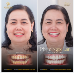 KHI NIỀM HẠNH PHÚC KHÔNG CẦN NÓI THÀNH LỜI