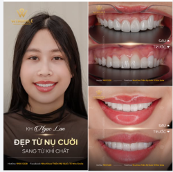 ĐIỂM CHẠM TINH TẾ TỪ NHỮNG ĐƯỜNG CONG TUYỆT MỸ
