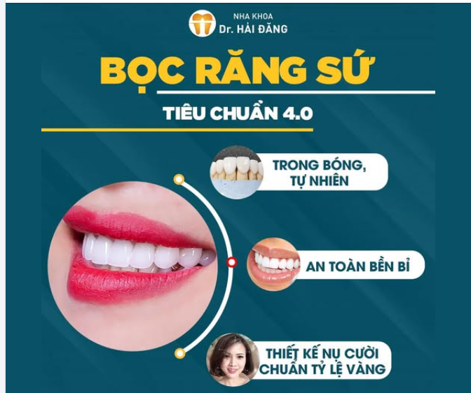 BỌC RĂNG SỨ TIÊU CHUẨN 4.0 – KIẾN TẠO NỤ CƯỜI TỰ NHIÊN SANG TRỌNG