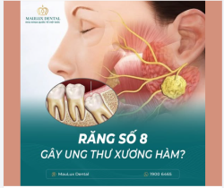 RĂNG SỐ 8 MỌC NGẦM - ĐỪNG CHỦ QUAN!