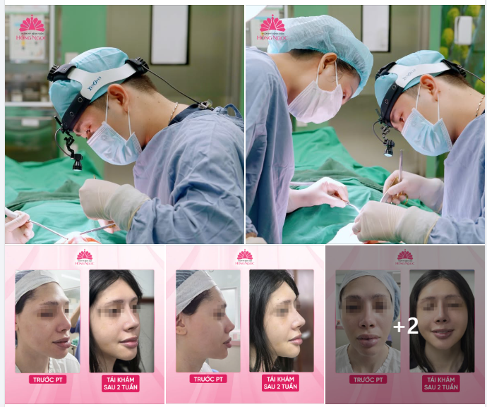 CHỈNH SỬA 1 LẦN - CÂN CHỈNH TOÀN DIỆN CẢ GƯƠNG MẶT