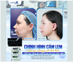 CHỈNH HÌNH CẰM LẸM, TÁI TẠO ĐƯỜNG NÉT HÀI HÒA