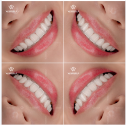 KHI NỤ CƯỜI ĐƯỢC THIẾT KẾ ĐỂ KỂ CÂU CHUYỆN RIÊNG