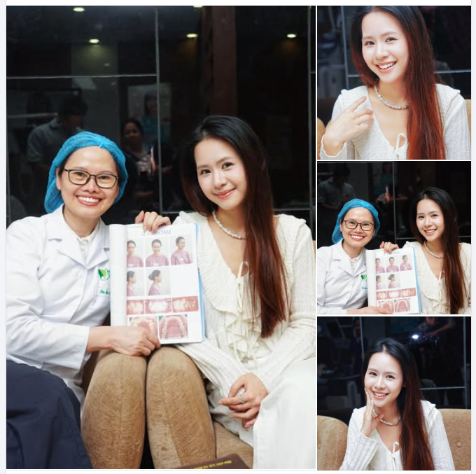 Hành trình niềng răng là một quá trình – và kết quả là một nụ cười xứng đáng