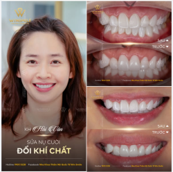 Mỗi nụ cười là một câu chuyện, nhưng không phải câu chuyện nào cũng bắt đầu bằng sự hạnh phúc