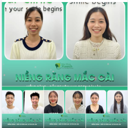 NIỀNG RĂNG – ĐẦU TƯ HÔM NAY, TỰ TIN DÀI LÂU