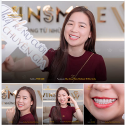 Gặp chị Trang vào một ngày nắng đẹp tại Win Smile, ấn tượng đầu tiên về chị là một cô gái Bắc Ninh nhỏ nhắn, sở hữu khuôn mặt baby cực kỳ xinh xắn.