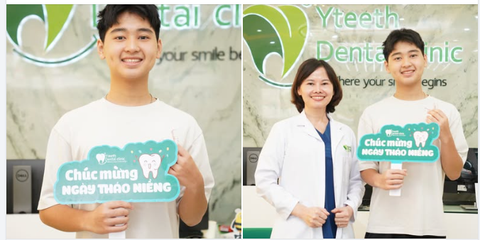 Ngày tháo niềng – ngày nụ cười được “giải phóng”