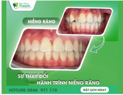 Sự thay đổi không đến trong một ngày – mà là cả một hành trình