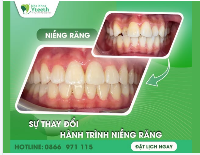 Sự thay đổi không đến trong một ngày – mà là cả một hành trình