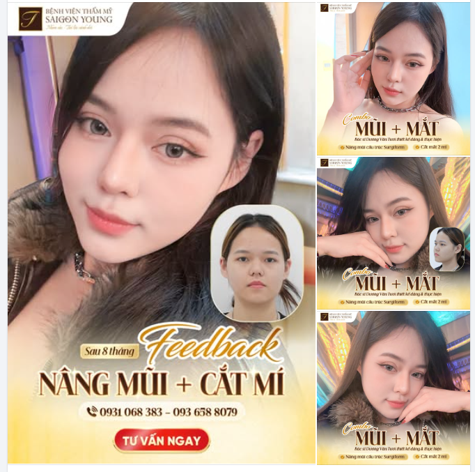 MÊ MẨN TRƯỚC DÁNG MŨI MẮT SIÊU TỰ NHIÊN