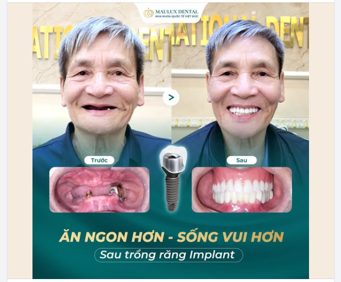 HÀNH TRÌNH LẤY LẠI NỤ CƯỜI VÀ SỨC KHỎE CỦA CHÚ MAI XUÂN TIẾN