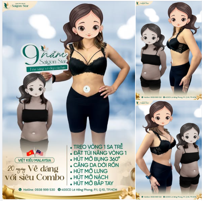 DR. HOẠT VẼ LẠI ĐƯỜNG CONG CHO KHÁCH HÀNG VIỆT KIỀU MALAYSIA