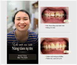 ĐỔI MỚI NỤ CƯỜI - NÂNG TẦM TỰ TIN