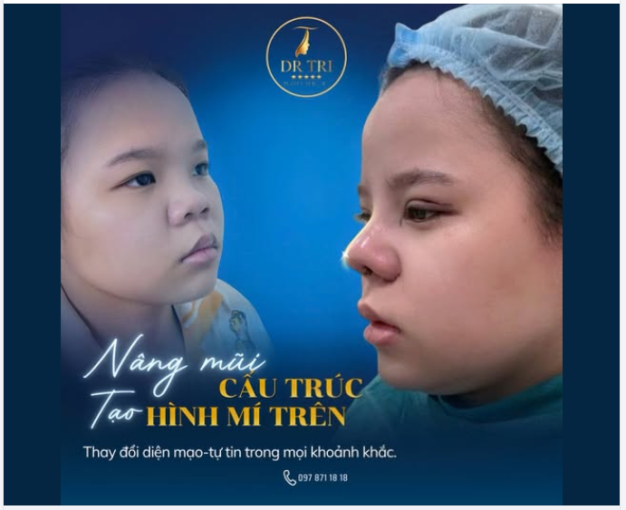 TẠM BIỆT TỰ TI - ĐÓN ĐẦU DIỆN MẠO MỚI