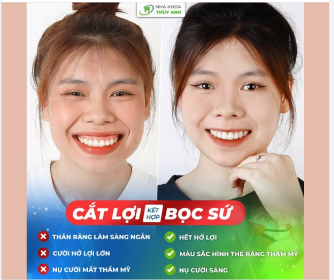 GIẢI PHÓNG KHỎI NỤ CƯỜI HỞ LỢI, RẠNG RỠ ĐÓN ĐẠI LỄ