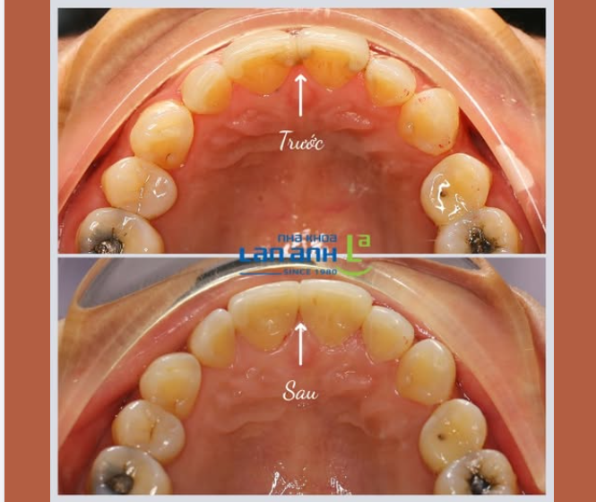 Đôi khi một lần kiểm tra định kỳ đúng lúc sẽ giúp hạn chế được những vấn đề lớn hơn về sau.