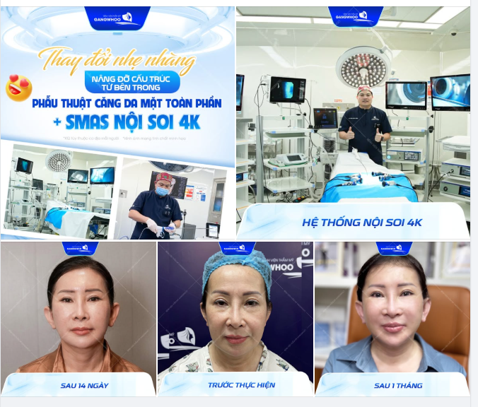 THAY ĐỔI NHẸ NHÀNG - NÂNG ĐỠ CẤU TRÚC TỪ BÊN TRONG