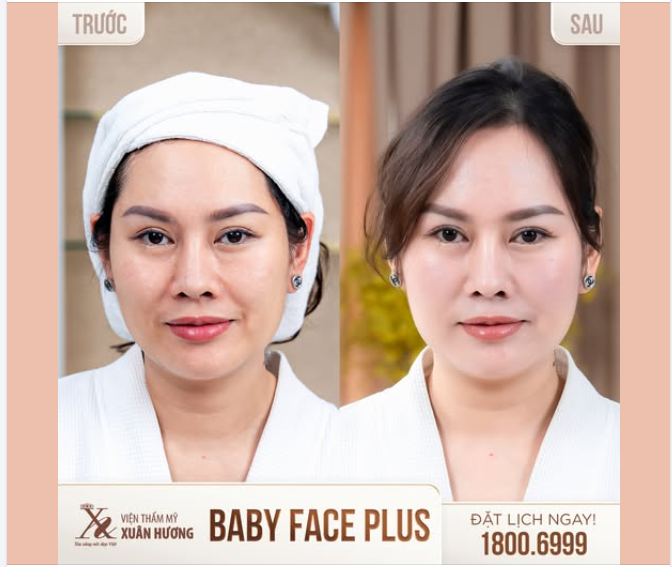 BABY FACE PLUS - SỰ NÂNG CẤP VỀ PHƯƠNG PHÁP CHĂM SÓC DA
