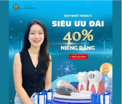 DUY NHẤT THÁNG 5 – SIÊU ƯU ĐÃI 40% NIỀNG RĂNG