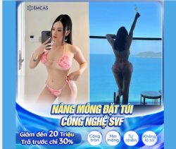 NÂNG CẤP VÒNG 3 HOÀN HẢO TẠI EMCAS