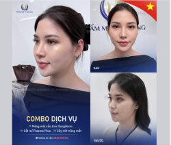 Nhan sắc thăng hạng – Xinh sang mọi góc nhìn