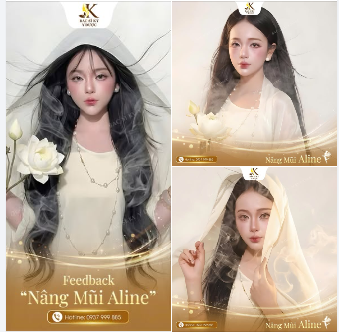 Feedback nâng mũi Aline – Khi nhan sắc hóa nàng tiên