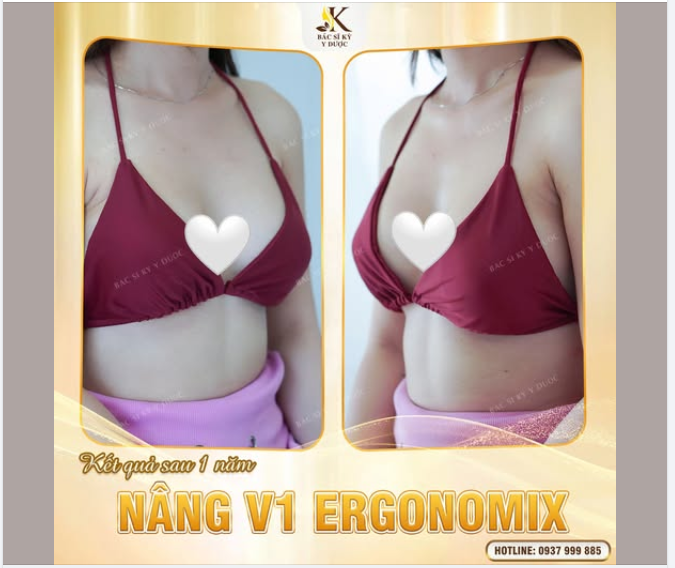 Mùa hè đến rồi  Đã đến lúc tự tin khoe trọn những đường cong mình yêu nhất