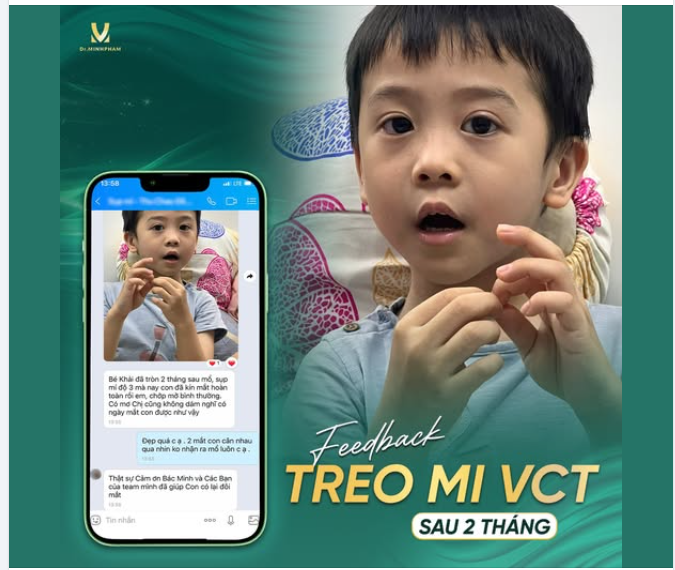 Feedback sau treo mi VCT