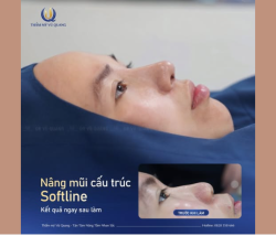 Mũi thấp tẹt bất lợi đủ đường ?