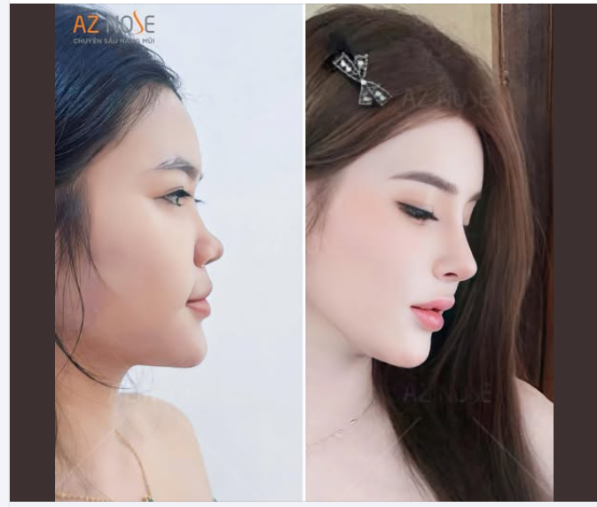 Bạn đang cần động lực để thay đổi? Hãy để AZNOSE đồng hành cùng bạn nhé!