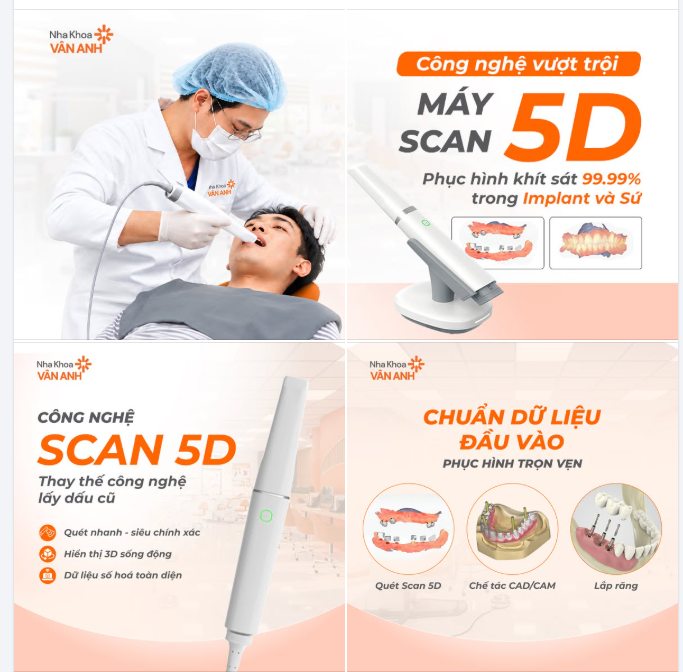 CÔNG NGHỆ SCAN 5D - Bản đồ 3D và chiếc "camera thám tử" thay đổi kết quả phục hình Implant