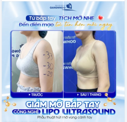 TỰ TIN DIỆN ÁO HAI DÂY CỦA CÔ GÁI TRẺ