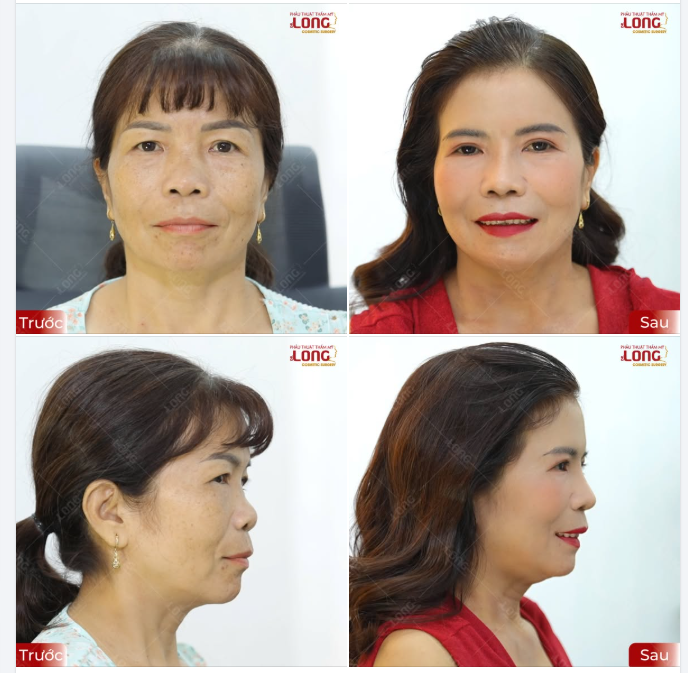Điều gì ẩn chứa đằng sau 2 chữ XINH ĐẸP ?