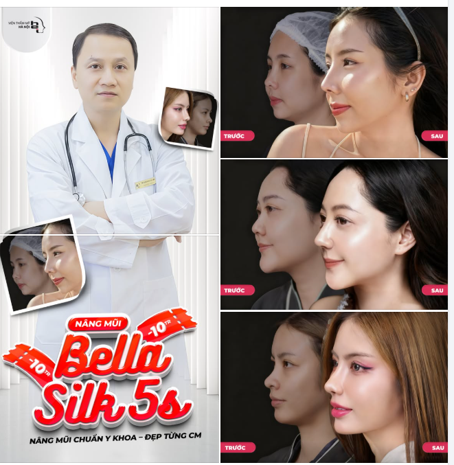NÂNG MŨI BELLA SILK 5S - THĂNG HẠNG NHAN SẮC