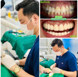 Sau 24h bác sĩ căng não cùng sự miệt mài của anh em labor kết quả BN cũng happy