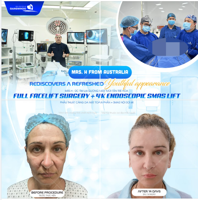 MRS.H - ÚC TÌM LẠI GƯƠNG MẶT TƯƠI TẮN TRẺ HÓA