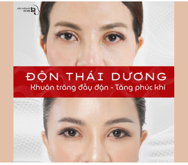 ĐỘN THÁI DƯƠNG - TƯỚNG MẶT TĂNG PHÚC KHÍ