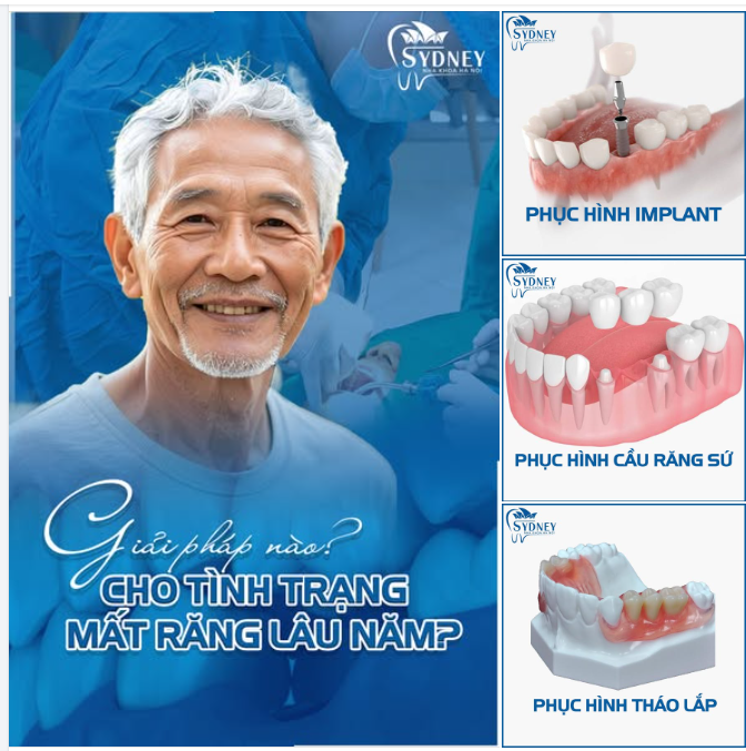 GIẢI PHÁP NÀO CHO TÌNH TRẠNG MẤT RĂNG LÂU NĂM?