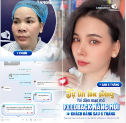 TỰ TIN TỎA SÁNG VỚI DIỆN MẠO MỚI
