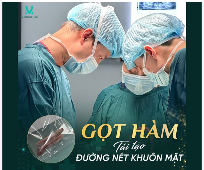 GỌT HÀM – TÁI TẠO ĐƯỜNG NÉT GƯƠNG MẶT