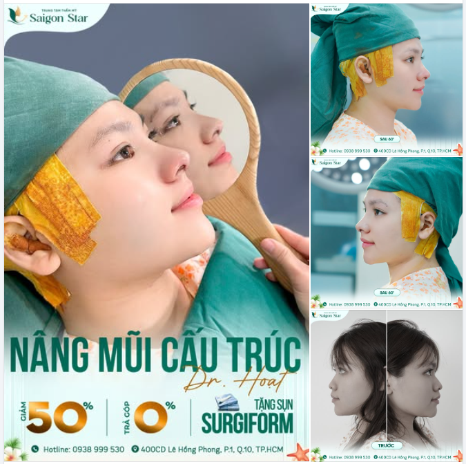Bé khách Gen Z đã chính thức “đổi vía” thành công sau khi săn được DEAL NÂNG MŨI SIÊU HỜI tại Mega Live 23/04 của Saigon Star
