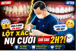Đẹp nhanh như vậy… có bền không?