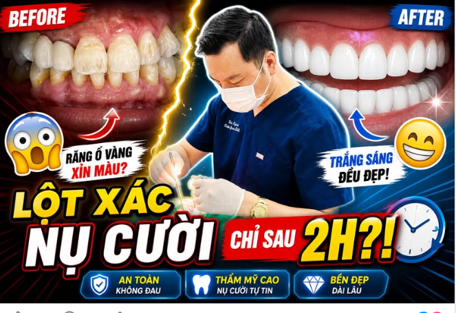 Đẹp nhanh như vậy… có bền không?