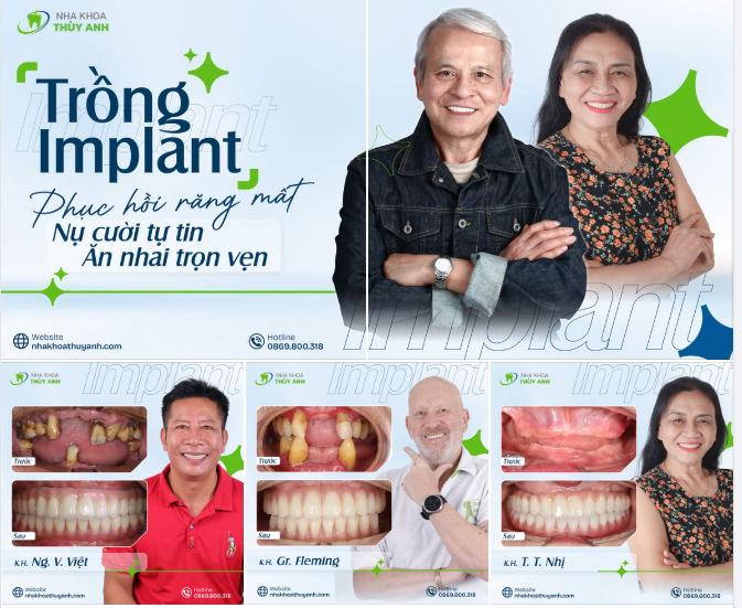 MẤT RĂNG LÂU NĂM – ĐỪNG ĐỂ ĐẾN KHI KHÔNG THỂ ĂN NHAI MỚI ĐI TRỒNG RĂNG
