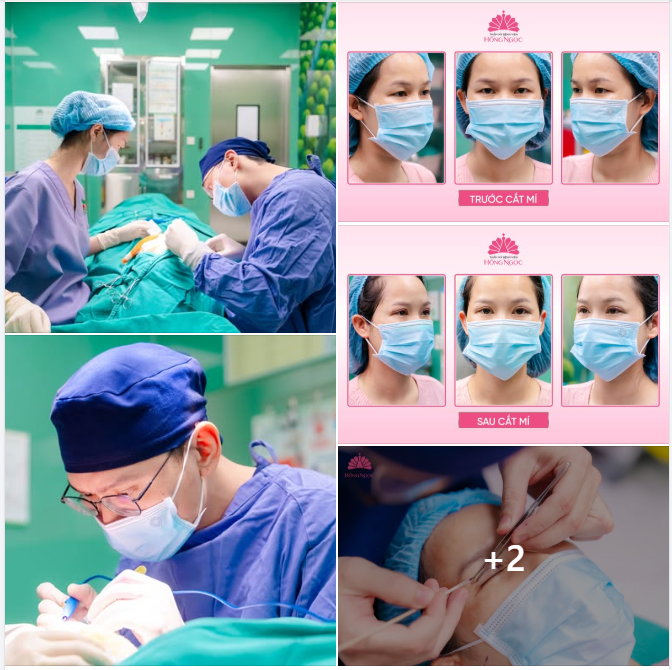 CẮT MÍ HÀN QUỐC - KIẾN TẠO NẾP MÍ TỰ NHIÊN, ÁNH NHÌN TƯƠI TRẺ, CUỐN HÚT