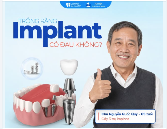 TRỒNG RĂNG IMPLANT CÓ ĐAU KHÔNG? - SỰ THẬT TỪ NGƯỜI "TỪNG TRẢI" 65 TUỔI